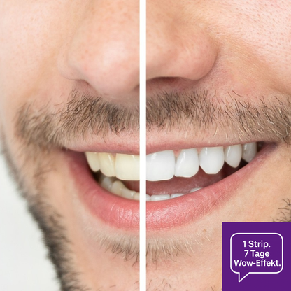 V34 Whitening Strips