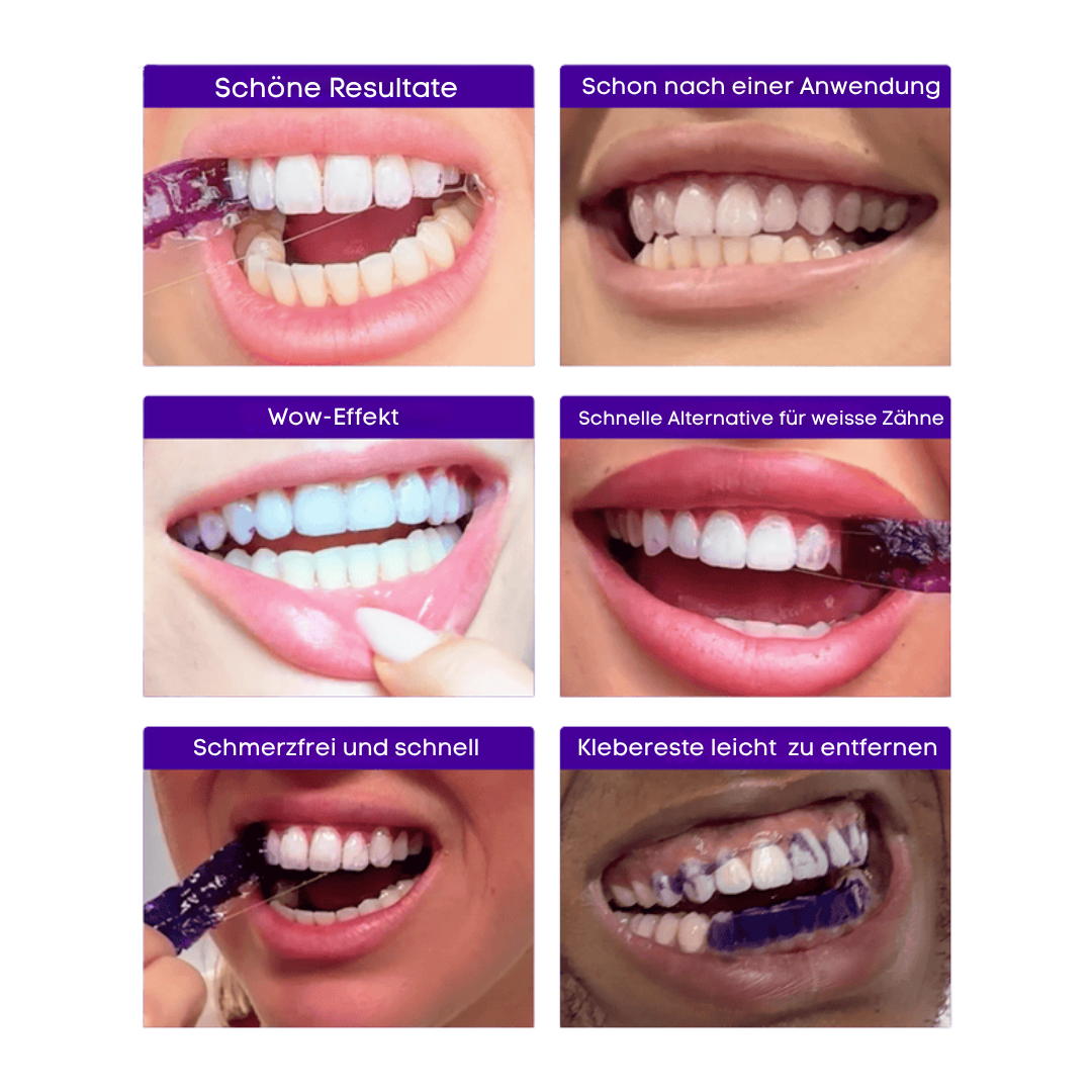 V34 Whitening Strips